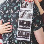 couple hugging and holding ultrasound of baby